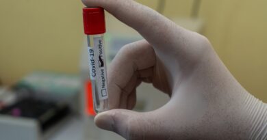 Teste PCR em Cancún: Onde fazer exame do COVID para retornar ao Brasil onde fazer teste pcr covid em cancun